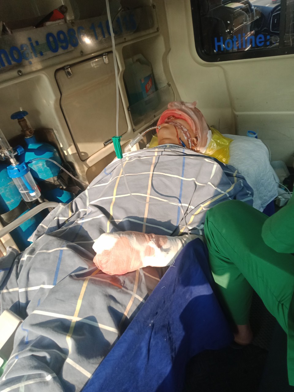 Xót xa hoàn cảnh nam sinh chấn thương nặng trong vụ tai nạn xe khách ở Tuyên Quang- Ảnh 2.