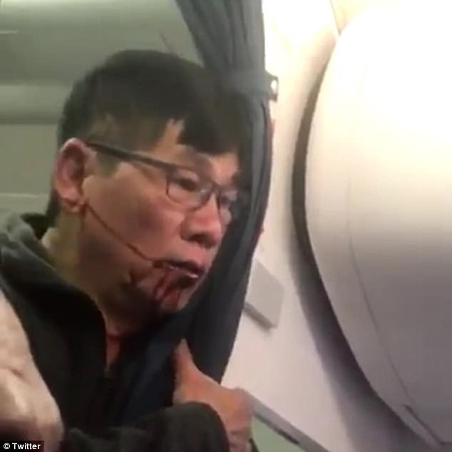 Bác sĩ châu Á bị lôi khỏi máy bay United Airlines 