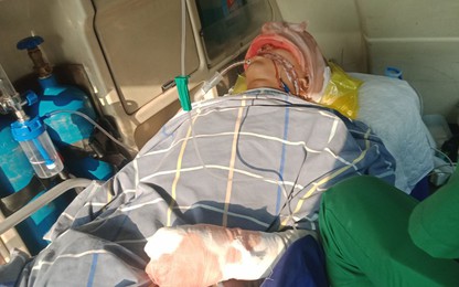 Xót xa hoàn cảnh nam sinh chấn thương nặng trong vụ tai nạn xe khách ở Tuyên Quang
