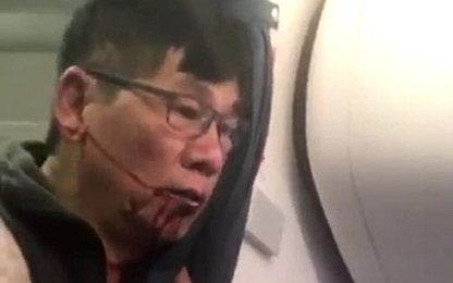 Cổ phiếu United Airlines "hồi sinh” sau vụ đẩy khách gốc Việt khỏi máy bay