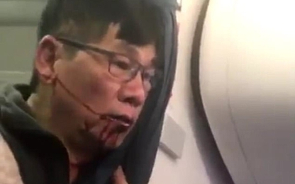 United Airlines đạt thỏa thuận đền bù với bác sĩ gốc Việt
