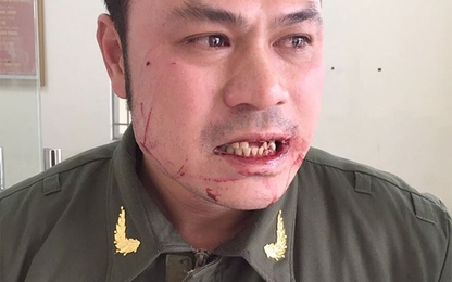 Nhân viên an ninh hàng không Nội Bài bị đánh gãy răng
