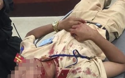 Một đại úy CSGT bị người vi phạm đập đá vào đầu nhập viện