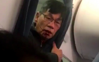 Hành khách gốc Việt sẽ thành triệu phú nếu kiện United Airlines?
