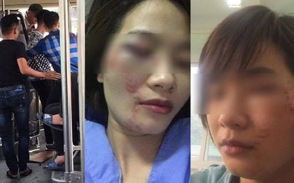 Truy nã 2 thanh niên đánh bầm dập nữ nhân viên xe buýt
