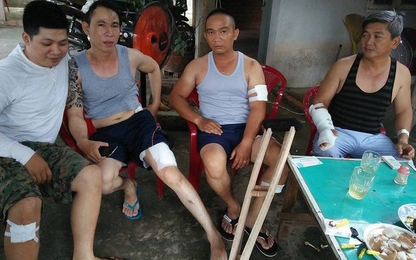 Băng côn đồ ở Sài Gòn vác mã tấu chém 4 người bị thương