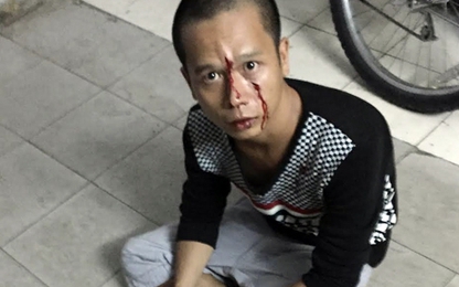 Tên cướp bị bắt vì kẹt xe ở Sài Gòn