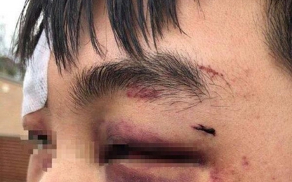 Du học sinh Trung Quốc bị đánh vì không cho thuốc lá