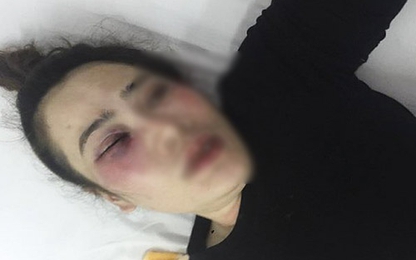 Nam thanh niên đánh dập mặt một phụ nữ vì cái bánh xèo