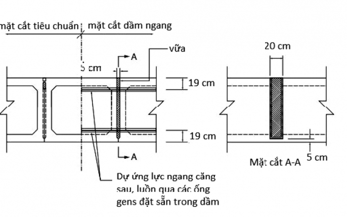 Mô hình giải phẫu đốt sống và tủy sống mặt cắt ngang